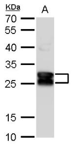 CRYBA1 Polyclonal Antibody