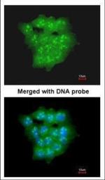 UBE2D1 Polyclonal Antibody