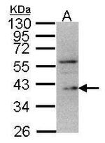 DUSP12 Polyclonal Antibody