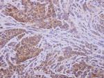 AKR1D1 Polyclonal Antibody