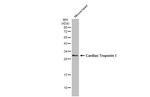 Cardiac Troponin I Antibody in Western Blot (WB)