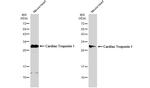 Cardiac Troponin I Antibody in Western Blot (WB)