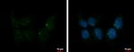 IFT80 Polyclonal Antibody