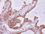 IFT80 Antibody in Immunohistochemistry (Paraffin) (IHC (P))