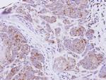 SEMA7A Antibody in Immunohistochemistry (Paraffin) (IHC (P))