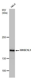 NSD3 Antibody in Western Blot (WB)