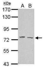 GRHL2 Polyclonal Antibody