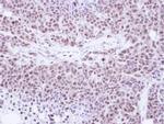 TKTL1 Antibody in Immunohistochemistry (Paraffin) (IHC (P))