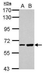 SPATA16 Antibody in Western Blot (WB)