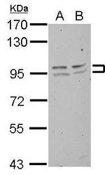 FXR2 Antibody in Western Blot (WB)