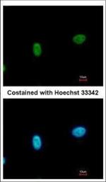 SMARCAL1 Polyclonal Antibody