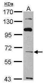 TBX4 Polyclonal Antibody