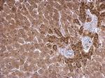 SCAP Polyclonal Antibody