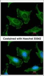 SEC23A Antibody in Immunocytochemistry (ICC/IF)
