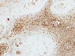 SEC23A Antibody in Immunohistochemistry (Paraffin) (IHC (P))