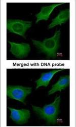 Cytokeratin 8 Polyclonal Antibody