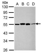 RUVBL1 Polyclonal Antibody