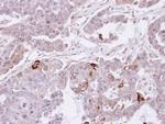 SEMA4A Polyclonal Antibody