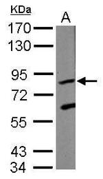 KRIT1 Polyclonal Antibody