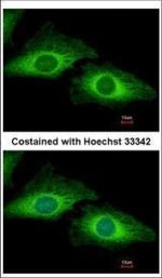 PDCD5 Polyclonal Antibody