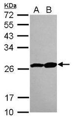 PSMB3 Polyclonal Antibody