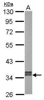 GRHPR Polyclonal Antibody