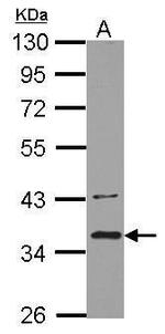 BRCC3 Polyclonal Antibody
