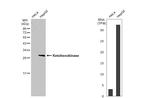 KHK Antibody in Western Blot (WB)