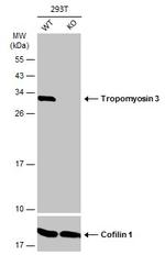 TPM3 Polyclonal Antibody