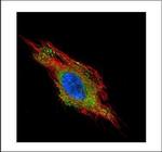 CHMP2B Antibody in Immunocytochemistry (ICC/IF)