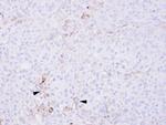 CCR6 Polyclonal Antibody