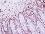 CBX4 Antibody in Immunohistochemistry (Paraffin) (IHC (P))