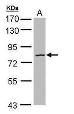 CBX4 Antibody in Western Blot (WB)