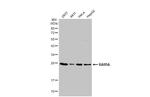 RAB5 Antibody in Western Blot (WB)