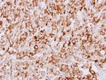 STUB1 Antibody in Immunohistochemistry (Paraffin) (IHC (P))
