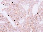 CCR2 Antibody in Immunohistochemistry (Paraffin) (IHC (P))