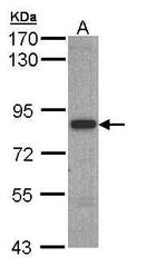 SH3BP2 Polyclonal Antibody