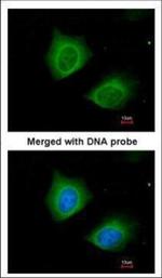 Cytokeratin 7 Polyclonal Antibody