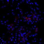 Cytokeratin 7 Antibody in Immunohistochemistry (Frozen) (IHC (F))