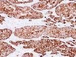 Cytokeratin 7 Antibody in Immunohistochemistry (Paraffin) (IHC (P))