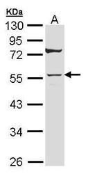 Cytokeratin 7 Antibody in Western Blot (WB)
