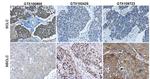 Cytokeratin 7 Antibody in Immunohistochemistry (Paraffin) (IHC (P))