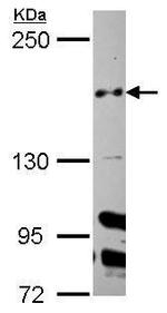 Cullin 7 Polyclonal Antibody