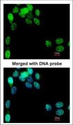 eIF2b epsilon Polyclonal Antibody