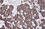 GAA Polyclonal Antibody