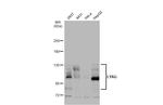 GAA Antibody in Western Blot (WB)
