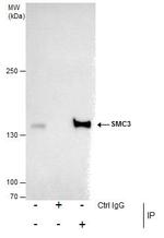 SMC3 Antibody in Immunoprecipitation (IP)