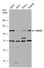 MARS Antibody in Western Blot (WB)