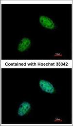 EXO1 Antibody in Immunocytochemistry (ICC/IF)