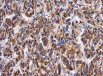 Myotilin Polyclonal Antibody